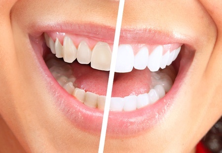 Dentist in Hoover AL