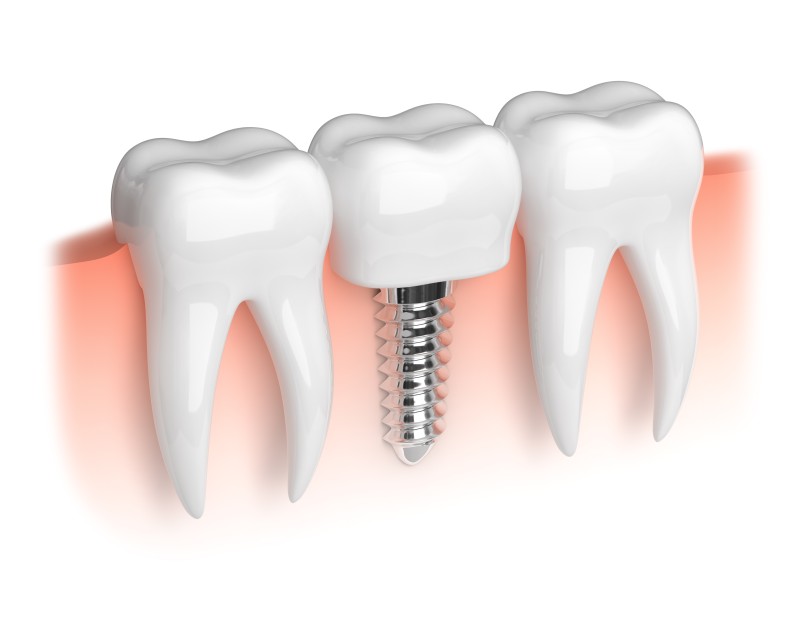 Cosmetic Dentistry Atlanta
