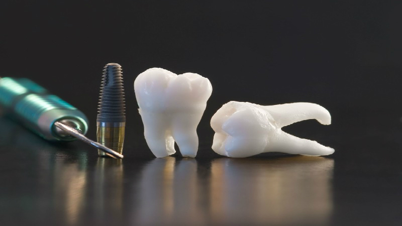 Dr. Charles Croasdill – Dentist Near You In Tacoma!