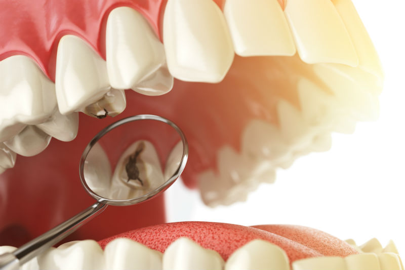 Teeth Whitening Services