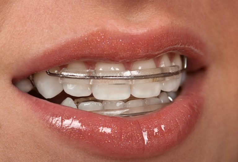 How Does Tooth Replacement Dentistry Work?