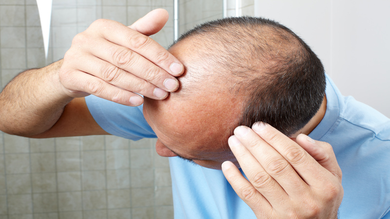 Hair Loss Doctor Charlotte