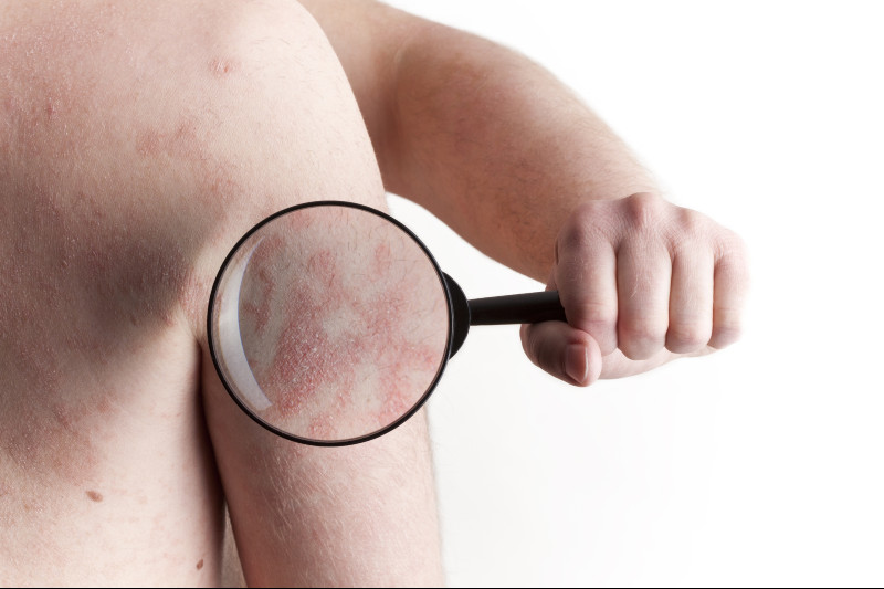 Get Best Scar Removal Treatment With Perfect Results At Dramov Naturopathic Medical In Portland