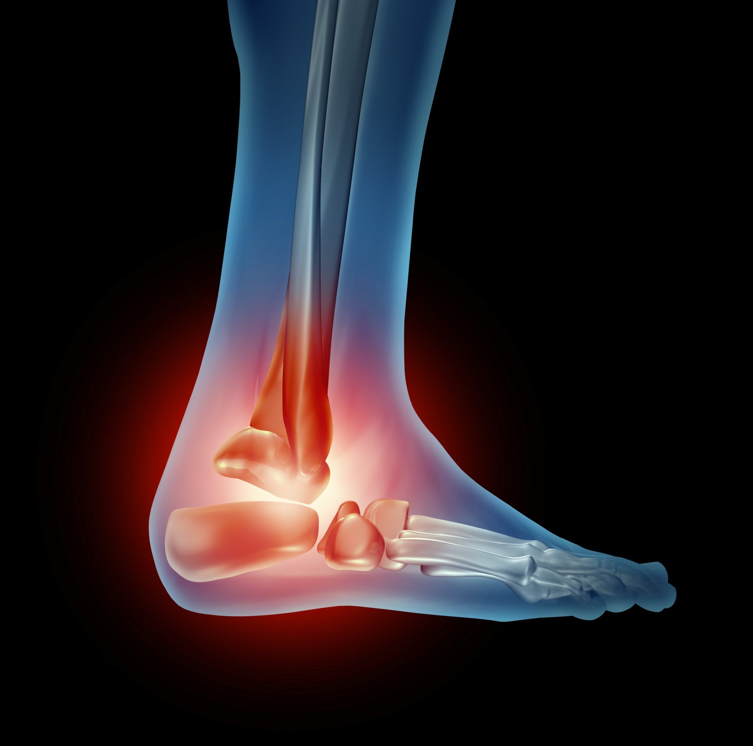 For Tennis Elbow Treatment In Helena MT Call Helena Orthopedic Clinic