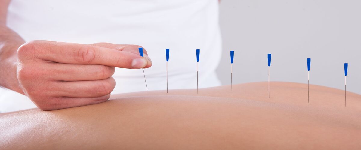 Acupuncture In Bellingham WA